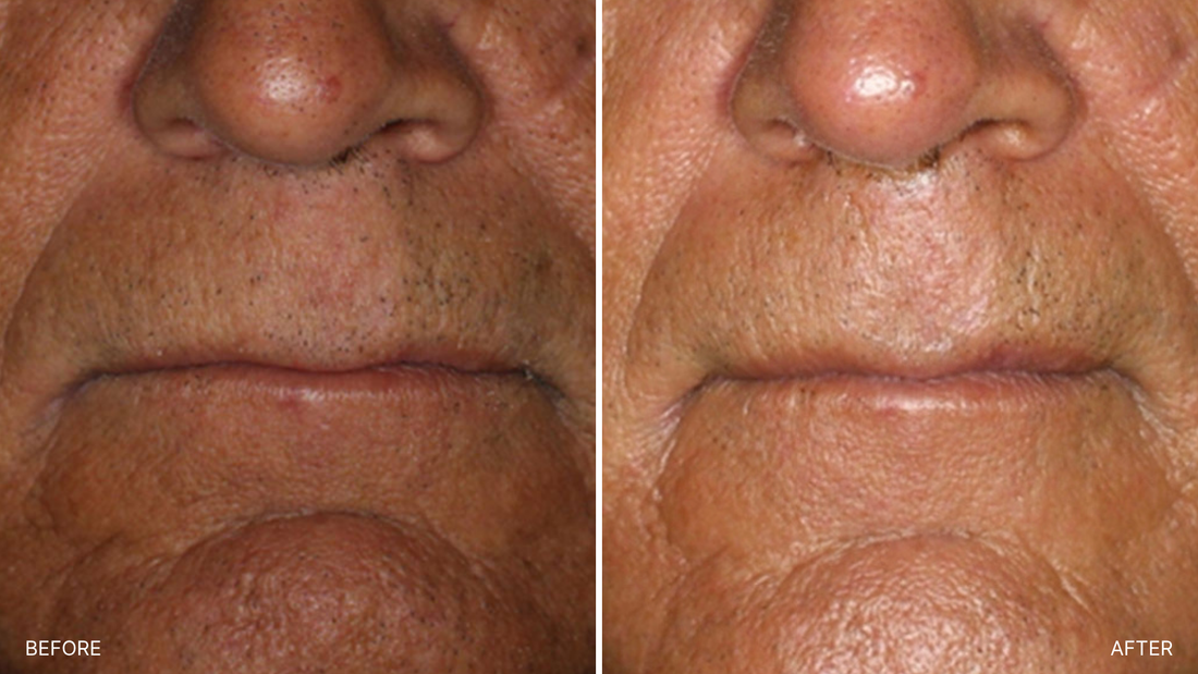 Environ Facials: The Science-Backed Skin Treatment Transforming Mature Skin After 30