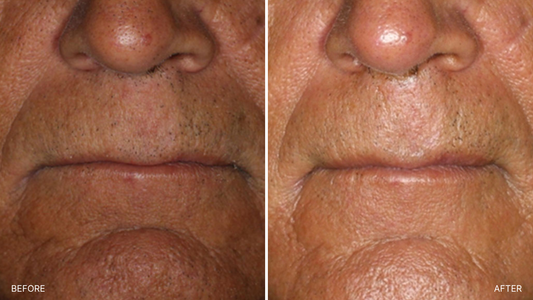 Environ Facials: The Science-Backed Skin Treatment Transforming Mature Skin After 30