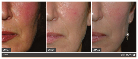 Environ Skin EssentiA Kit — Beginner Vitamin A Skincare Routine